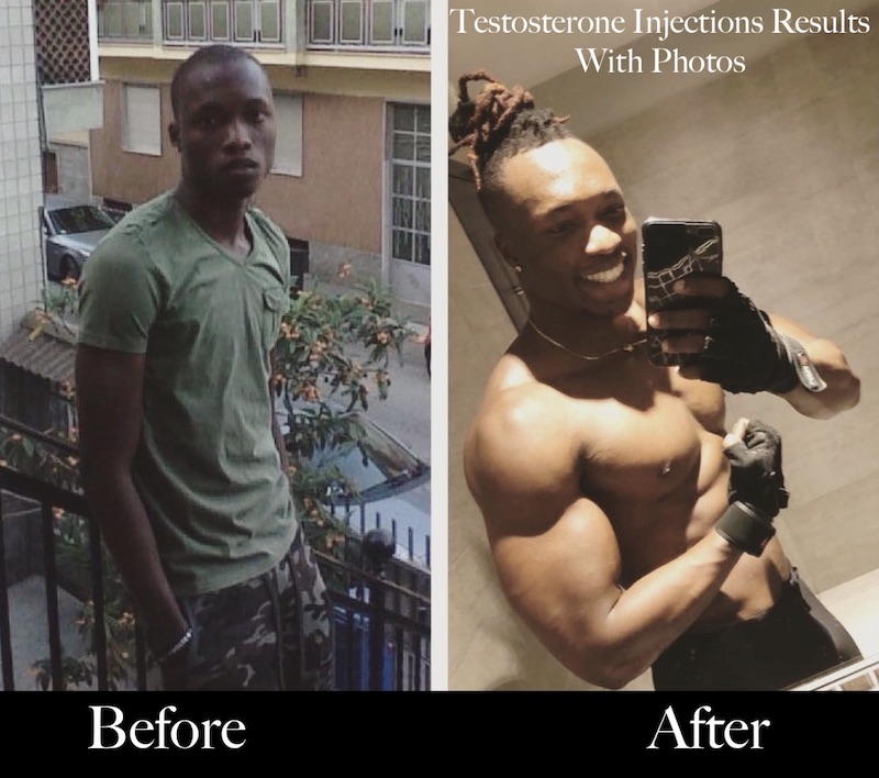 Testosterone-injections-before-and-after-photos-cyclegear